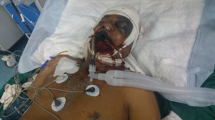  استشهاد ناشط بارز في الحراك متأثرا بإصابته