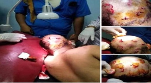 الربيزي : الحاقدون لن ينالوا من وطنية الحجيلي وإخلاصه لقضيته