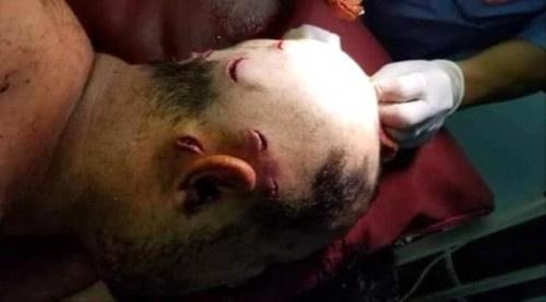 كاتب وإعلامي جنوبي: جريمة الاعتداء على الحجيلي مدبرة تهدف لإدخال الجنوبيين في صراع مناطقي