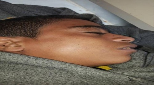 في رابع حادثة مأساوية.. وفاة طفل بصعق كهربائي بلحج