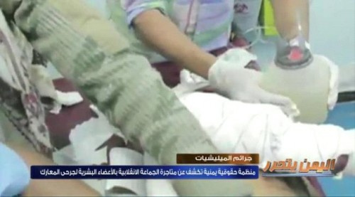 الكشف عن قيام #ميليشيا_الحـوثي الإنقلابية بالمتاجرة بأعضاء القتلى