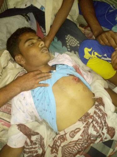 مليشيات #الحوثي تقتل مزارعا أعزلا من أبناء المسيمير على الحدود مع ماوية