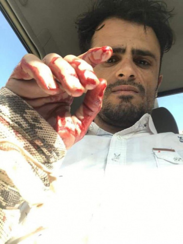 نقابة الصحفيين تدين مقتل المصور "لبحش" واستهداف الصحفي الشعيبي بقعطبة