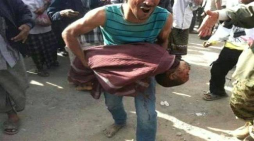 #مليشيا_الحـوثي ترتكب جرائم بشعة بحق النساء والأطفال ب#الضـالع