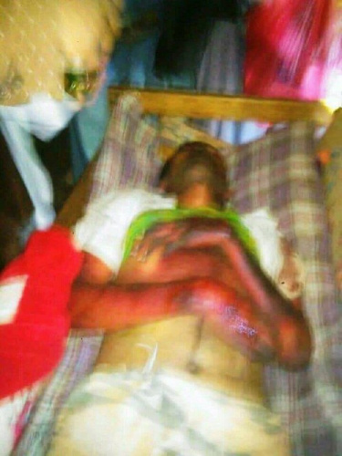 تعذيب 3 مختطفين حتى الموت في سجون مليشيات #الحـوثي ب#صنـعاء