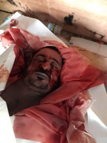 مقتل أحد المواطنين جراء التعذيب في معسكر للواء النقل بدار سعد