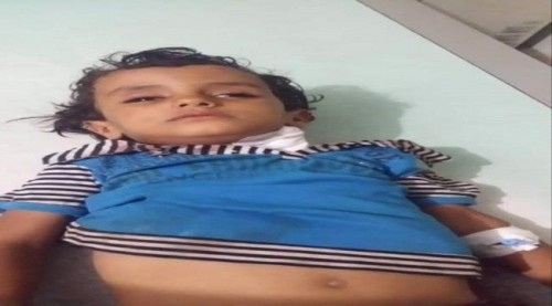 إصابة طفل من قرية الشغادر وسط  حجر بـ#الضـالع برصاص مليشيات #الحـوثي