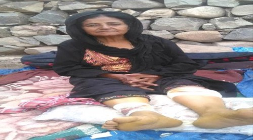 إصابة إمرأة بطلق ناري إثر استهداف المليشيات الحوثية قرية تورصة بالأزارق بسلاح الدوشكا