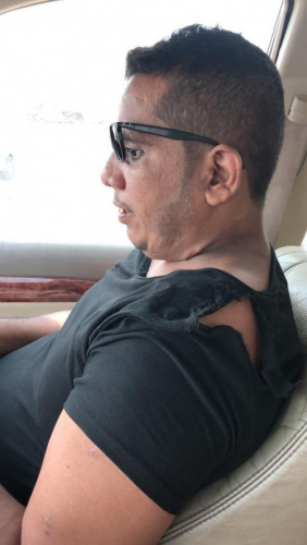 قوات امنية تابعة للشرعية تعتدي بالرصاص الحي والضرب على الصحفي جريح الحرب " صالح العبيدي 