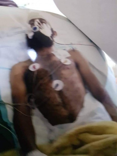 هو الثاني خلال اقل من 24 ساعة .. وفاة جريح من ابطال قوات #العمالقة الجنوبية بعد تعثر حصوله على جواز سفر (صورة)