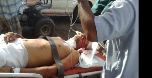 عاجــل.. استشهاد متظاهر جنوبي في عزان على يد قوات تابعة لمليشات الإصلاح (صورة)