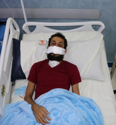 بدعم إماراتي .. إجراء أكثر من 30 عملية جراحية لجرحى #المقاومة_الجنوبية في #مصر منذ بداية أكتوبر الجاري