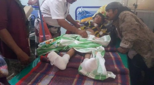 الضالع.. تعرض اسرة بأكملها للحروق بعد سقوط خط الضغط العالي على منزلها