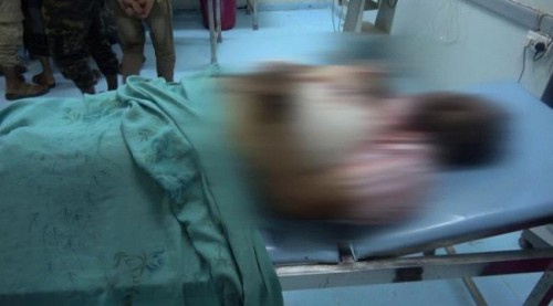 عبوة حوثية تودي بحياة 4 من اسرة واحدة ب#الحديدة