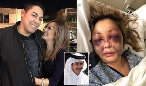 تورط شقيق أمير قطر خالد بن حمد آل ثاني في ضرب ممرضة أميركية