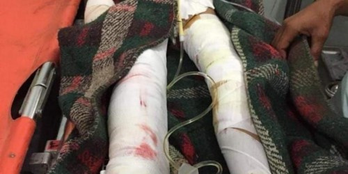 إصابة طفل اثر قصف حوثي استهدف منازل المدنيين شمال #الضالع