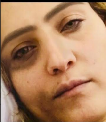 ناجية من سجون صنعاء.. تكشف الوجه القبيح لعبدالملك الحوثي مع الزينبيات