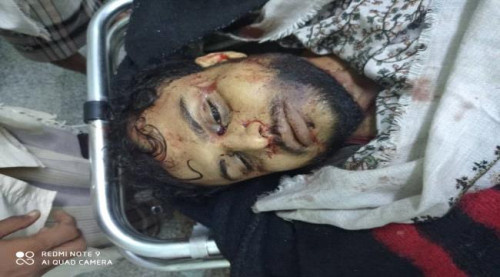 اغتيال نجل الشهيد علي صالح الحدي ومرافقه علاء الحميقاني في زنجبار ابين
