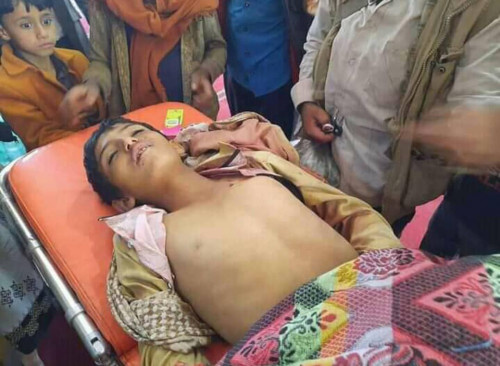 قناص حوثي يستهدف طفلاً في الضالع ويرديه قتيلا جوار منزله