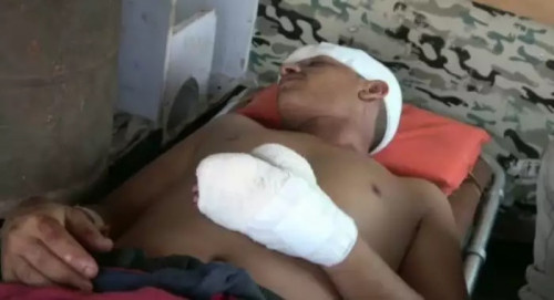 مليشيا الحوثي تستهدف سوقا بالدريهمي بطائرة مفخخة