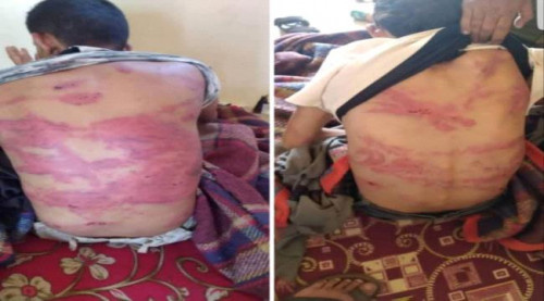 أمنية الضالع تؤكد إلقاء القبض على المتهمين بتعذيب واختطاف ثلاثًة شبان