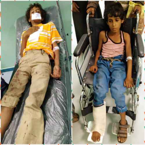 مليشيات الحوثي تستهدف طفلين بقذيفة هاون وتصيبهم بجروح متفرقة شمال الضالع