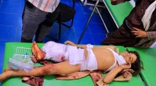 هجمات انتقامية.. المدنيون يدفعون ثمن تصعيد الحوثي