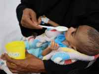 منظمة دولية تحذر من تفاقم أزمة سوء التغذية في اليمن